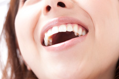 白い歯が輝く笑顔を手に入れるなら～審美歯科・ホワイトニング～