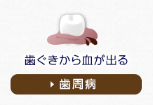 歯ぐきから血が出る歯周病