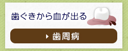 歯ぐきから血が出る歯周病